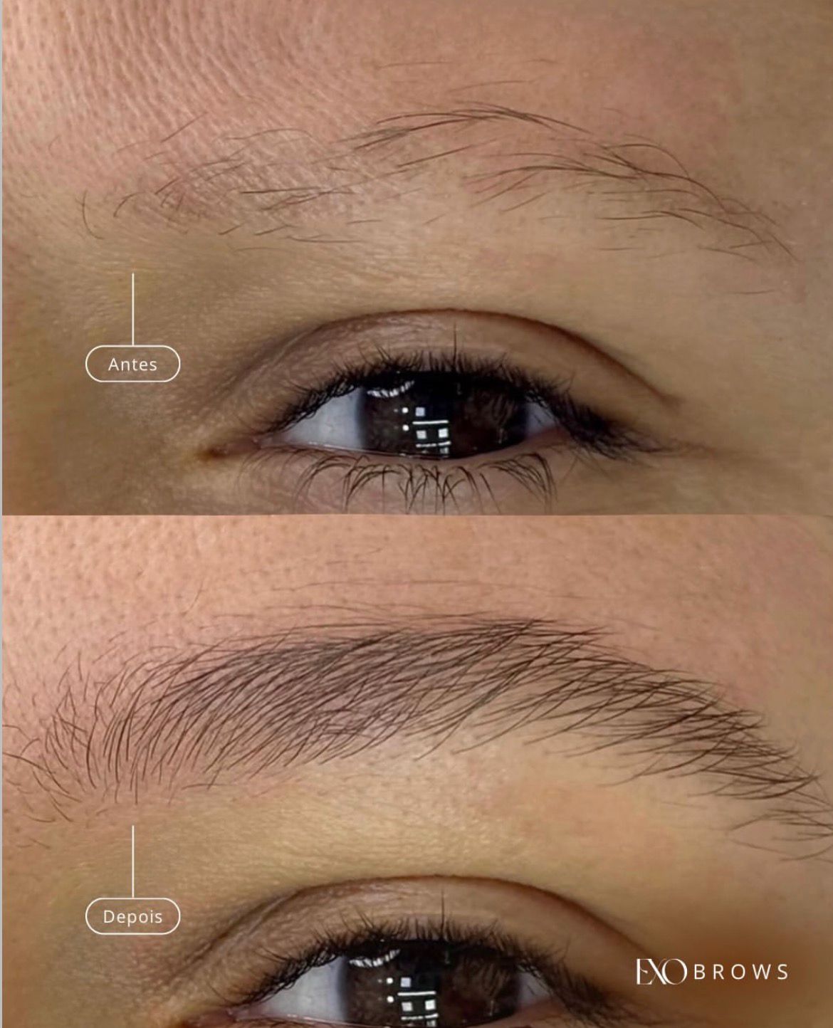 Resultado real — antes e depois