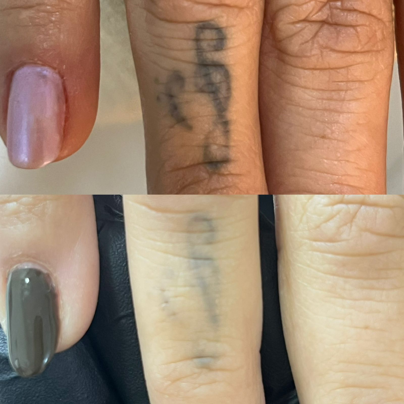 Resultado real — antes e depois