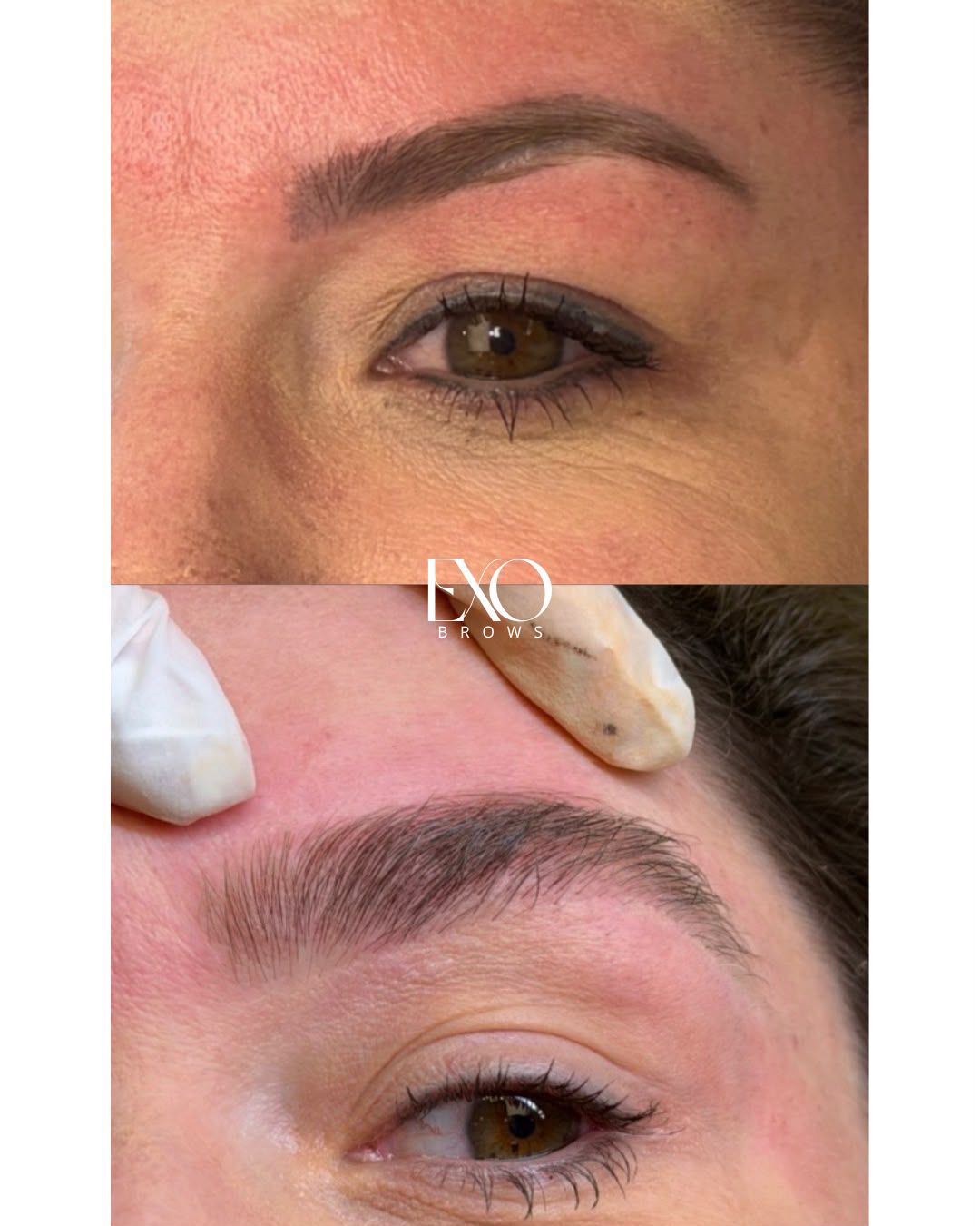 Resultado real — antes e depois