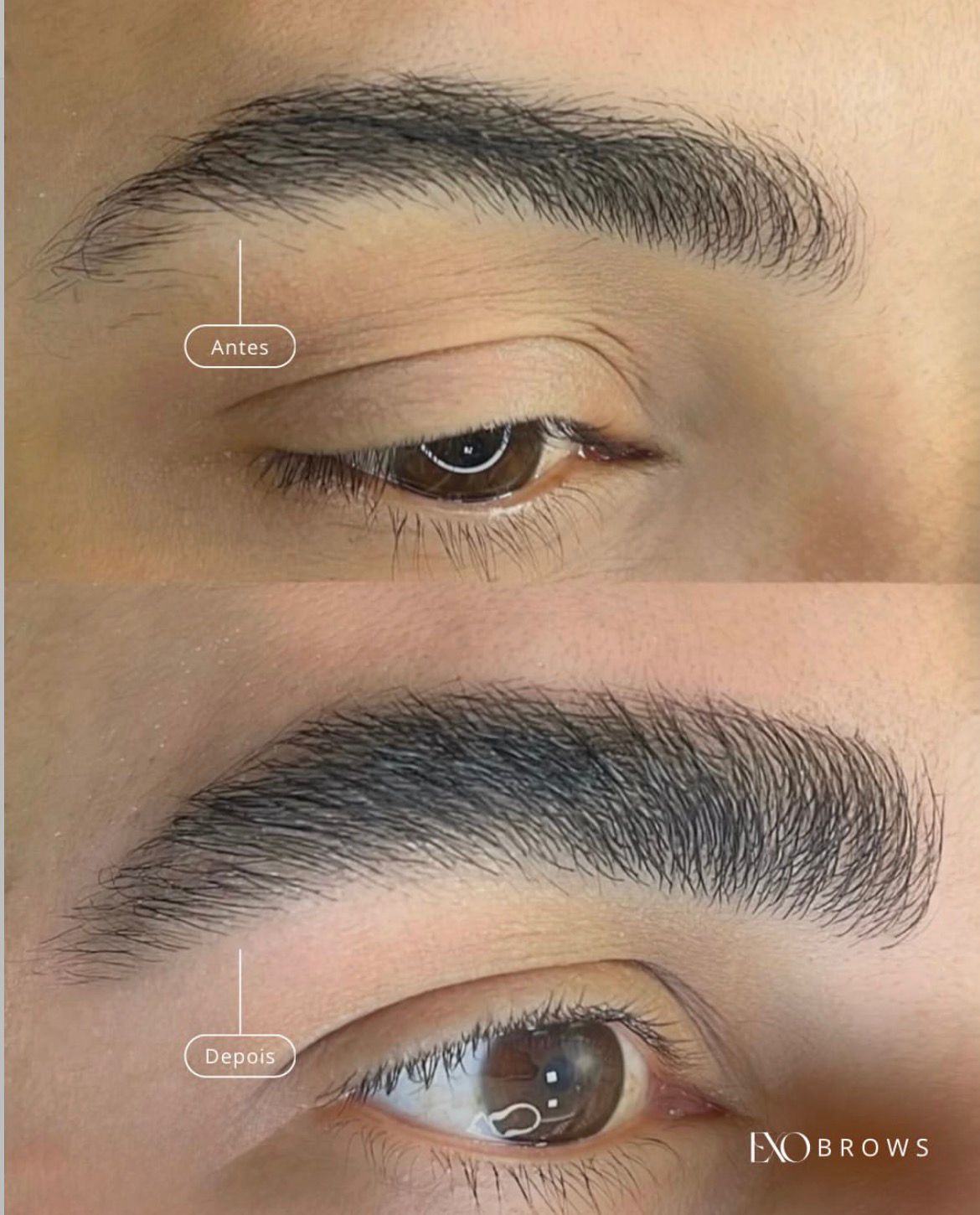 Resultado real — antes e depois