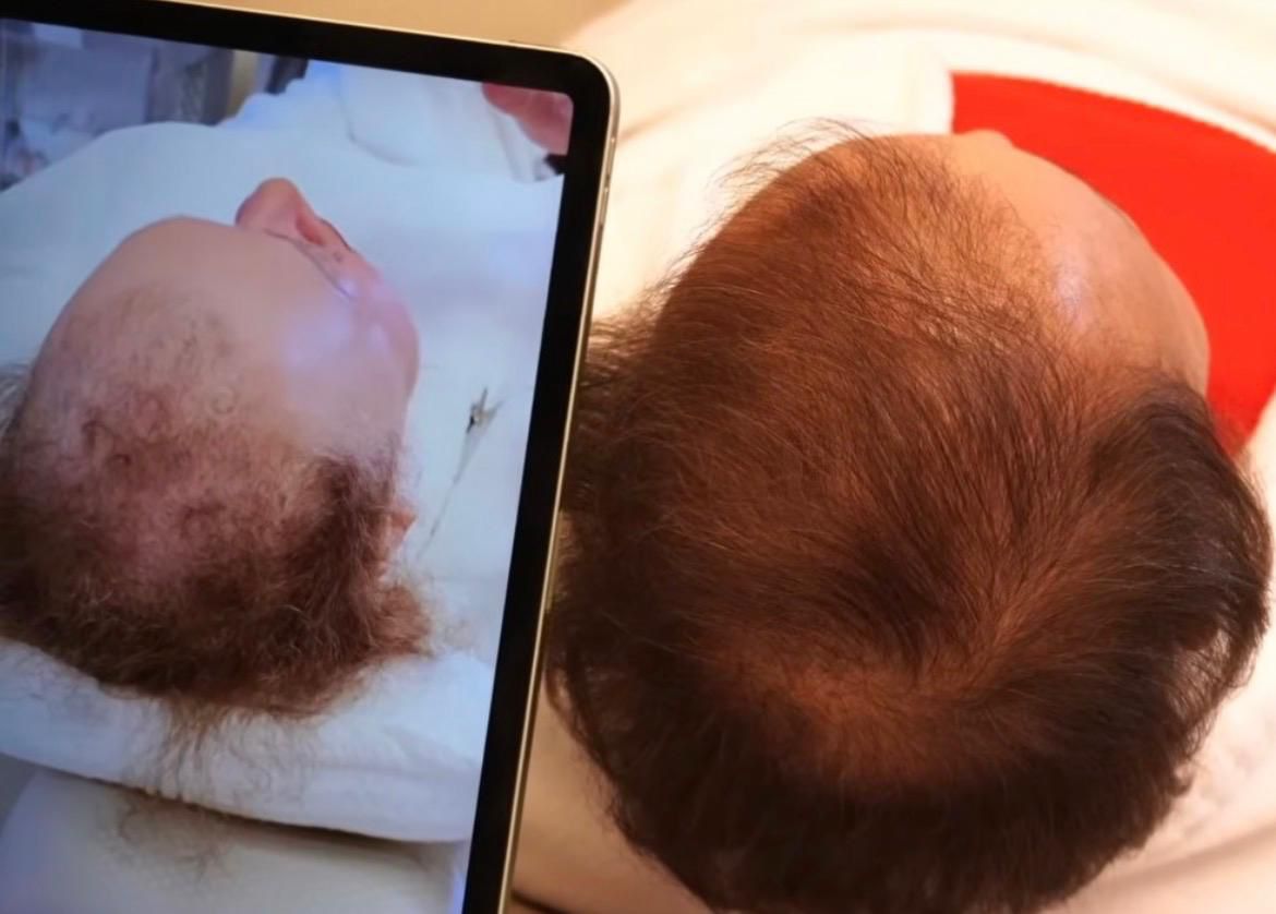 Resultado real — antes e depois