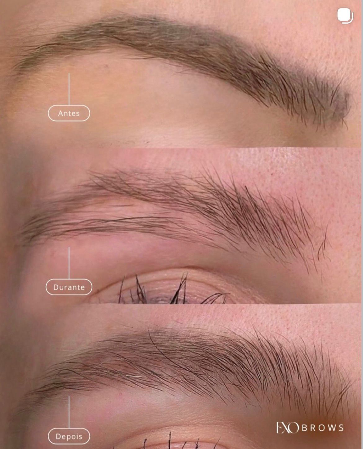Resultado real — antes, durante e depois